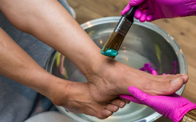 Nail fungus