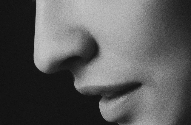Rhinoplasty