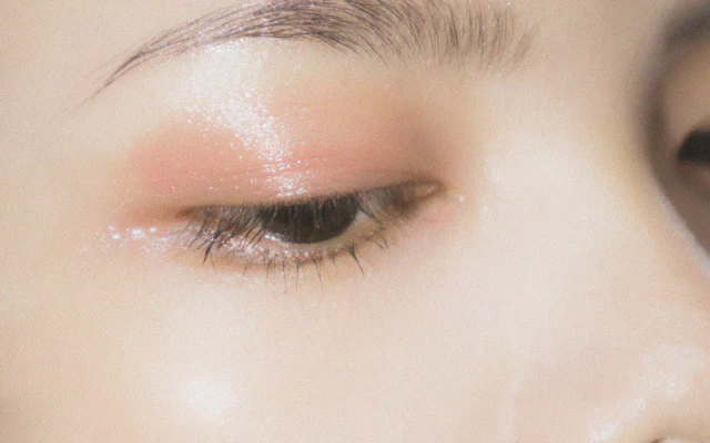 Blepharoplasty