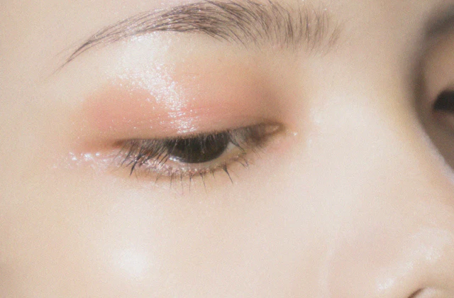 Blepharoplasty