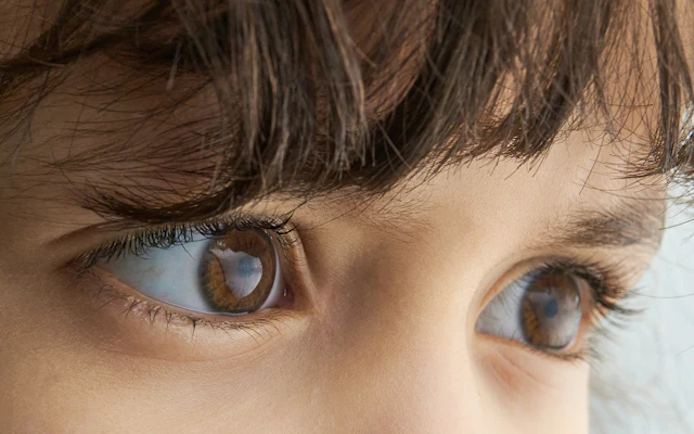 Strabismus in children