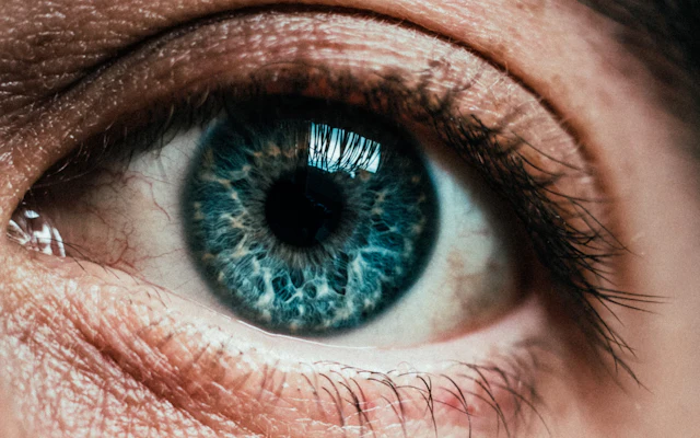 Keratoconus