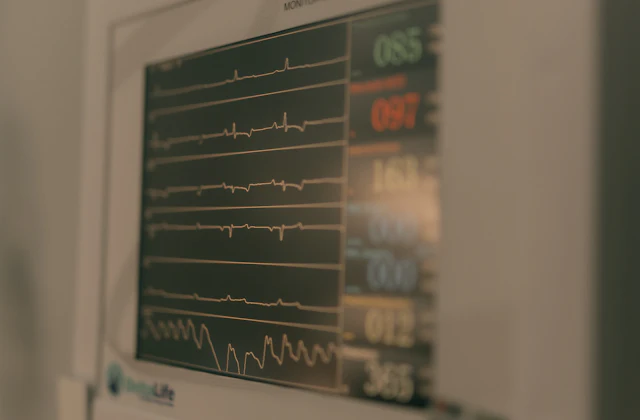 Catheter ablation for arrhythmia