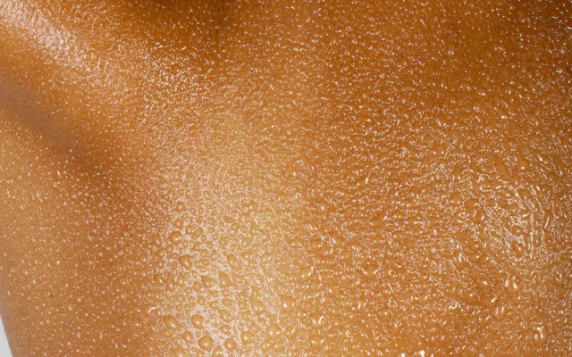 Eczema and atopic dermatitis