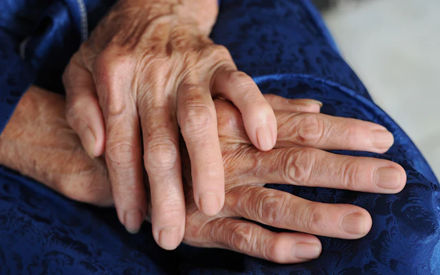 Hand and finger osteoarthritis